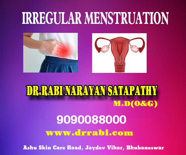 Best irregular menstruation treatment clinic in bhubaneswar near by capital hospital